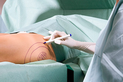 istanbul-liposuction